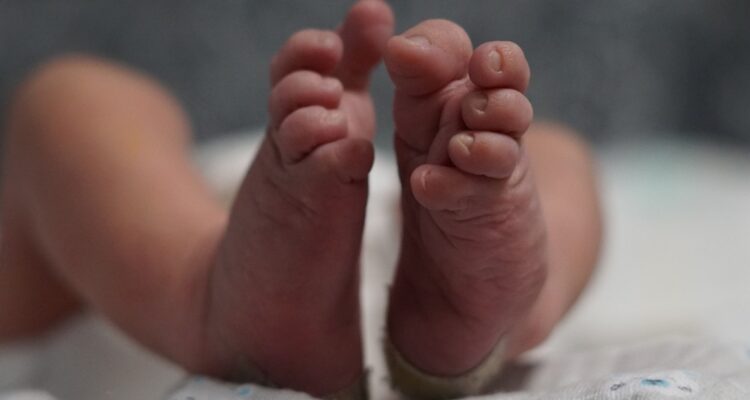 Padrastro le lanzó un hervidor durante una pelea: PDI relata cómo terminó quemado lactante de Pudahuel