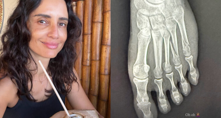 Leonor Varela y su pie