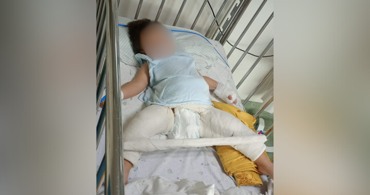¿Qué le pasó Lucas?: familia denuncia que tías de jardín le entregaron a su hijo con fractura de fémur