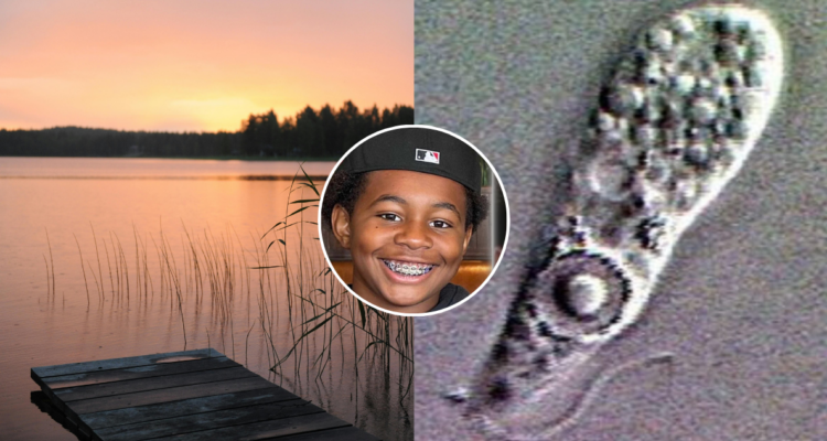 Niño muere al adquirir “ameba comecerebros” tras bañarse en lago en EEUU: ¿cuáles son los síntomas?
