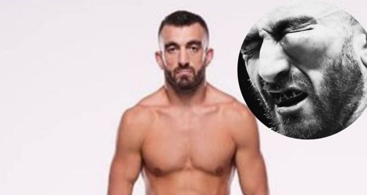 VIDEO | Así quedó el ojo de luchador de la UFC tras brutal golpiza