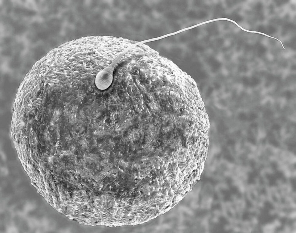 Dennis Kunkel Microscopy