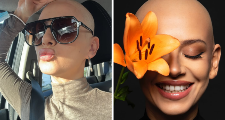 “Se lucha llorando, pero siempre digna”: Karla Melo emociona con reflexión tras 6 quimioterapias