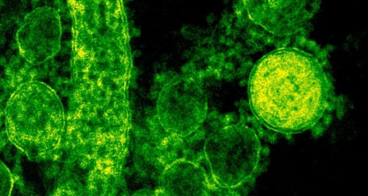 Bacteria carnívora que vive en el mar lleva 8 muertos en EEUU: se alimenta de carne humana