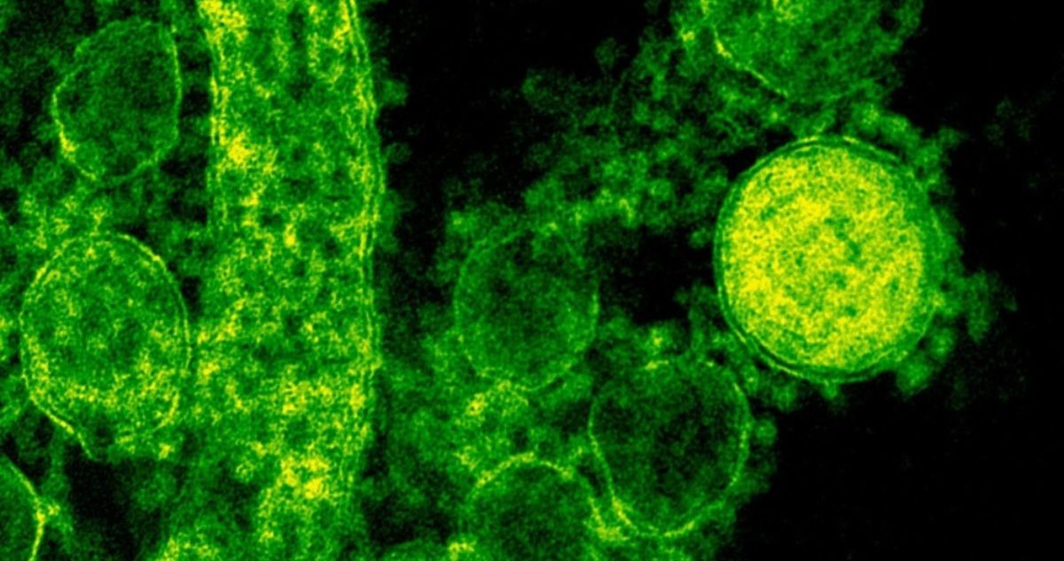 Bacteria carnívora que vive en el mar lleva 8 muertos en EEUU: se alimenta de carne humana