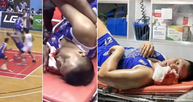 básquetbol agresión Filipinas