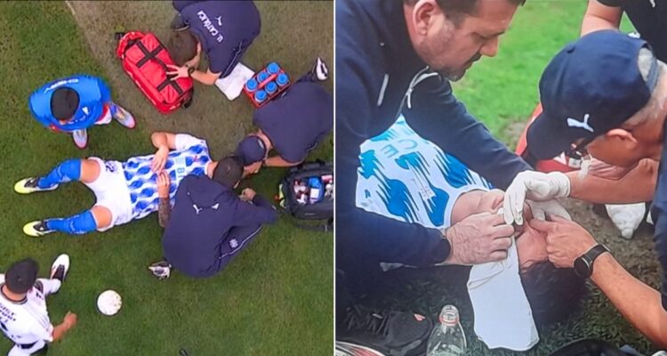 Colo Colo UC agresión Canales