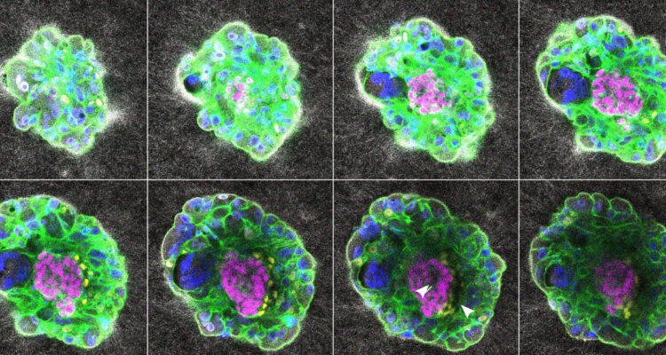 VIDEO | Científicos graban por primera vez cómo se implanta un embrión humano en el útero
