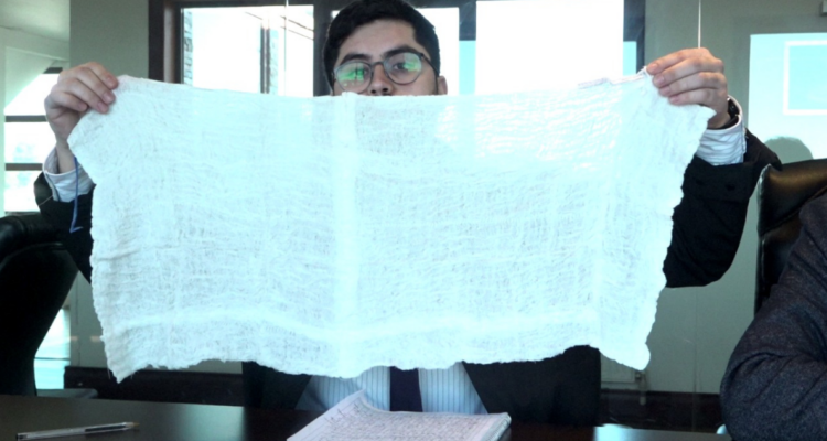 Mujer tuvo por más de un año compresa en su abdomen: fue “olvidada” tras cirugía en Hospital de Castro