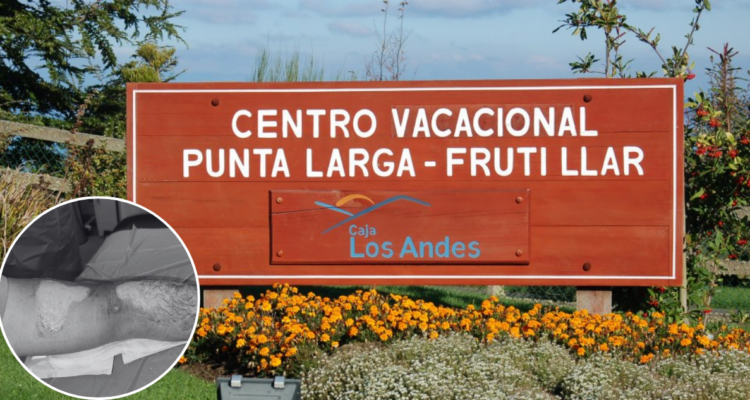 Paseo familiar termina en pesadilla: hombre queda con graves quemaduras por duchas de agua hirviendo