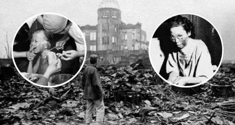 Las horrorosas secuelas y daños que sufrieron los “hibakusha”: sobrevivientes de Hiroshima y Nagasaki