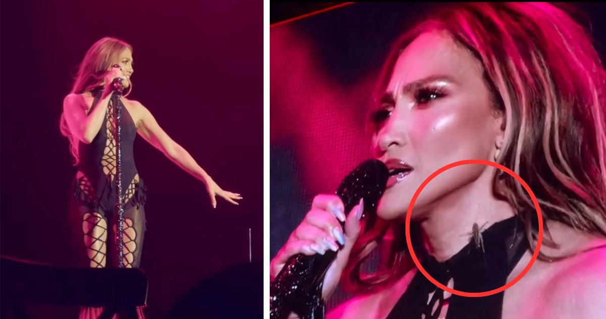 Siempre diga: la placidez de Jennifer Lopez tras verse enfrentada a enorme insecto en pleno concierto