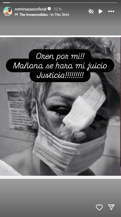 Romina Sáez revela que inició juicio por brutal golpiza que recibió en 2022