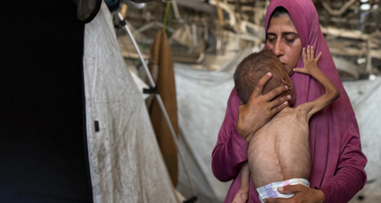 Niños en Gaza mueren por hambre y desnutrición