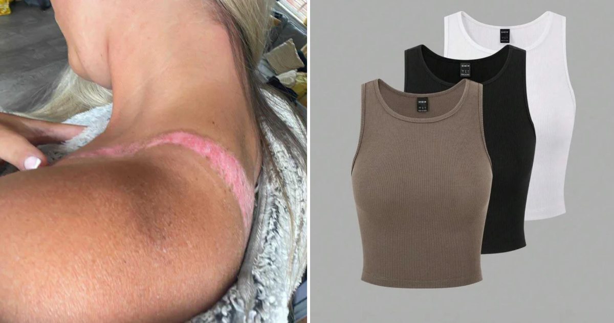 Joven lesiones por prenda de Shein