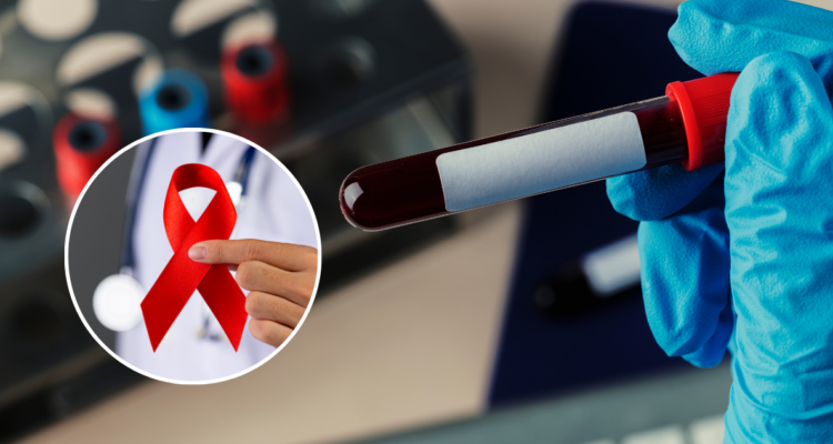 Expertos llaman a actualizar el modelo de atención en VIH y potenciar la detección temprana en Chile