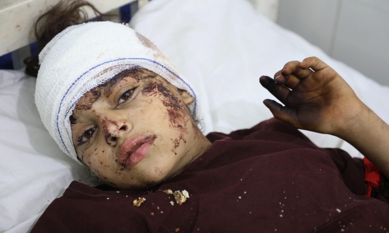 Un menor recibe tratamiento en un hospital en Jalalabad, Afganistán