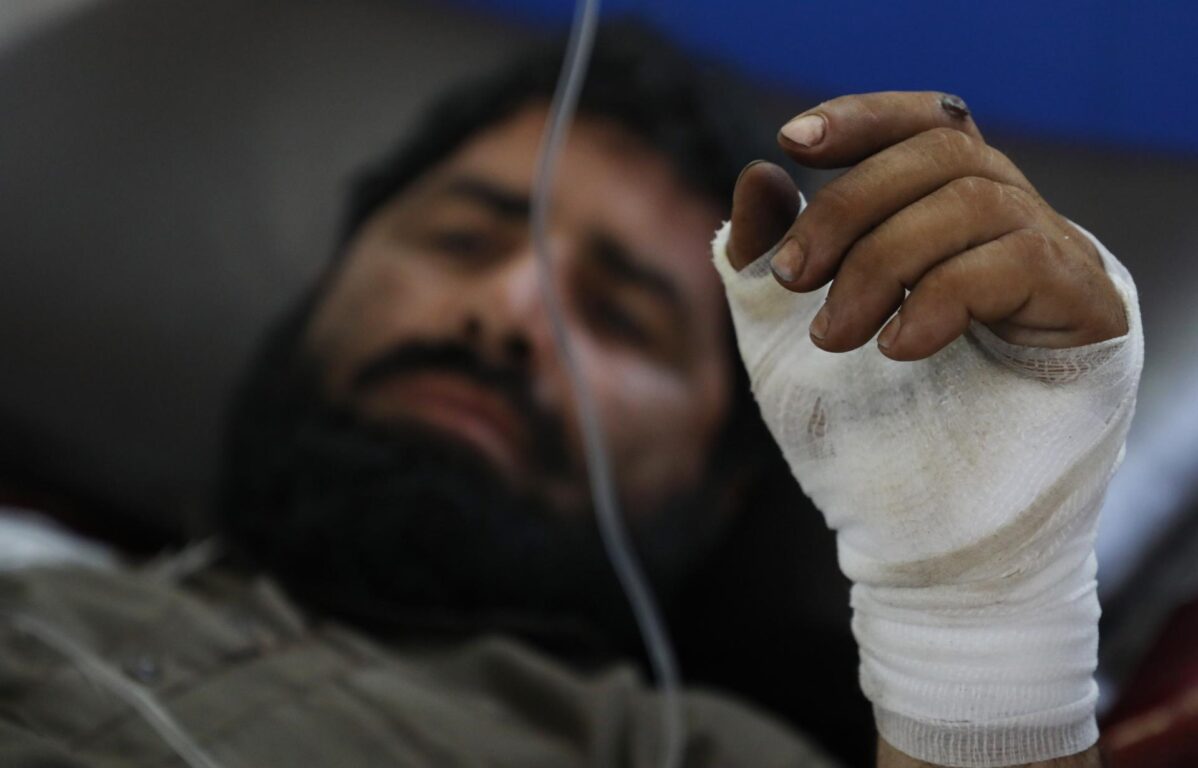 Un hombre recibe tratamiento en un hospital en Jalalabad, Afganistán 