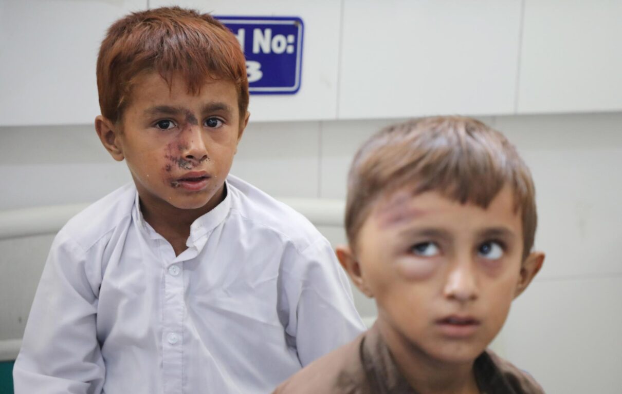 Niños heridos reciben tratamiento en un hospital en Jalalabad, Afganistán 