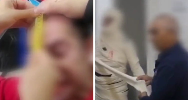 Denuncian caso de agresión a trabajador TEA en Hospital San Borja: víctima lleva años siendo golpeada