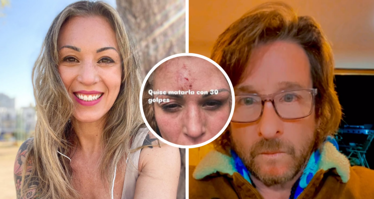 Ariela Madeiros, ex chica ‘Mekano’ y su expareja Antonio Lennon di Fonte, en referencia a golpiza