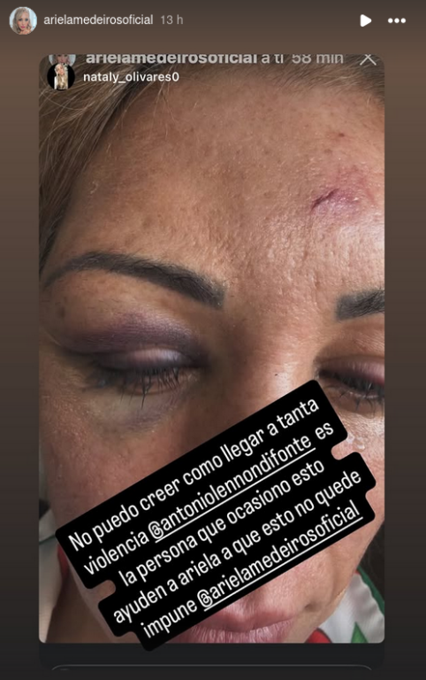 Fotografías compartidas por Ariela Medeiros, ex bailarina de 'Mekano'