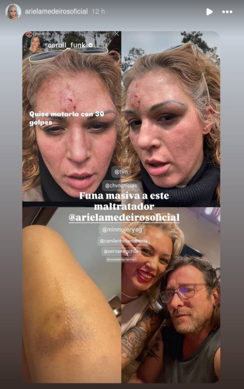 Fotografías compartidas por Ariela Medeiros, ex bailarina de 'Mekano'