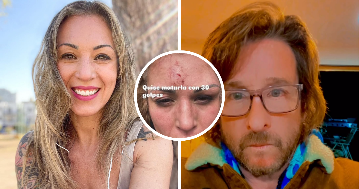 Ariela Madeiros, ex chica ‘Mekano’ y su expareja Antonio Lennon di Fonte, en referencia a golpiza