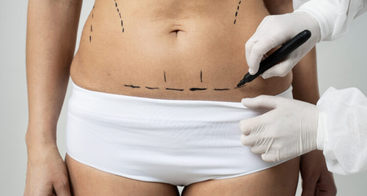 Estás son las 5 cirugías más solicitadas en Chile antes de que comience el verano