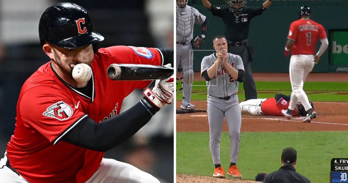 David Fry recibió pelotazo en el rostro a 160km/h en la MLB.