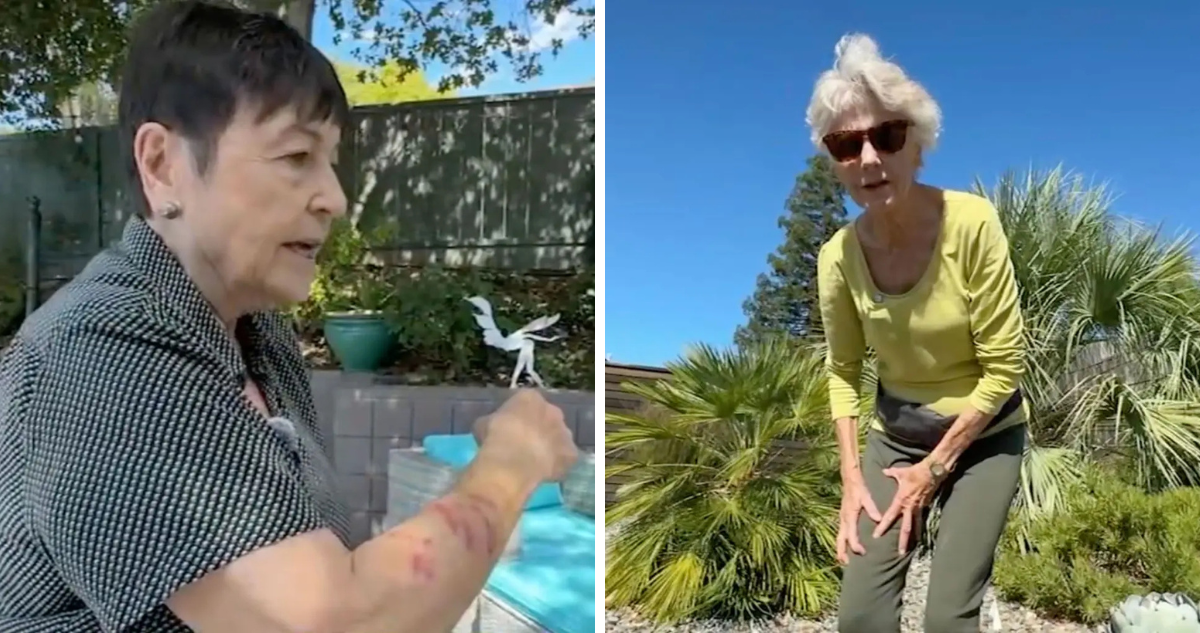 mujeres afectadas por la ardilla