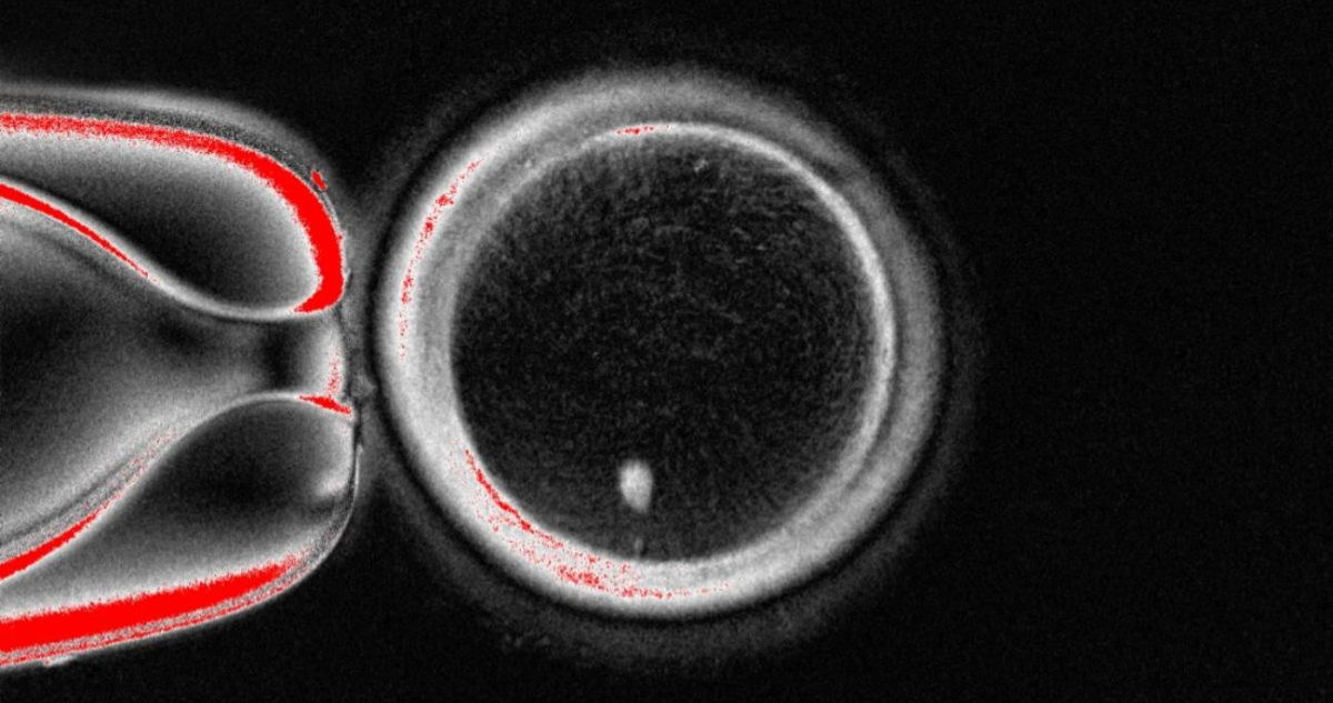Logran generar óvulos humanos funcionales a partir de células de la piel