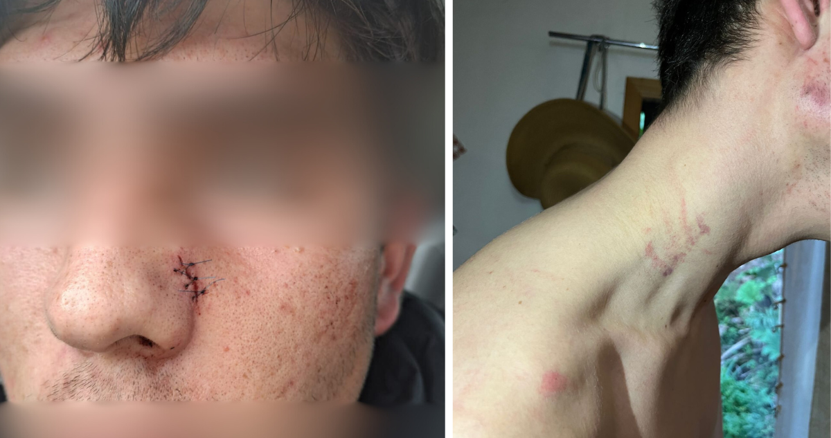 "Te vamos a violar": cómo pelea terminó en brutal agresión de joven con TEA por parte de Carabineros
