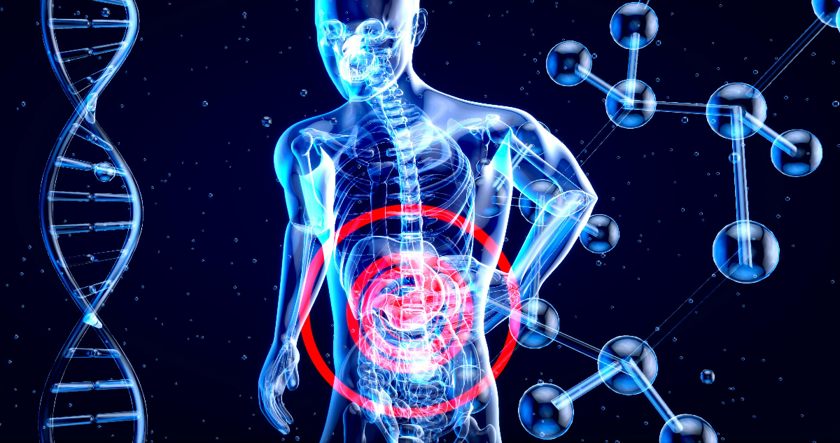 Imagen referencial para ilustrar nota sobre el cáncer gástrico