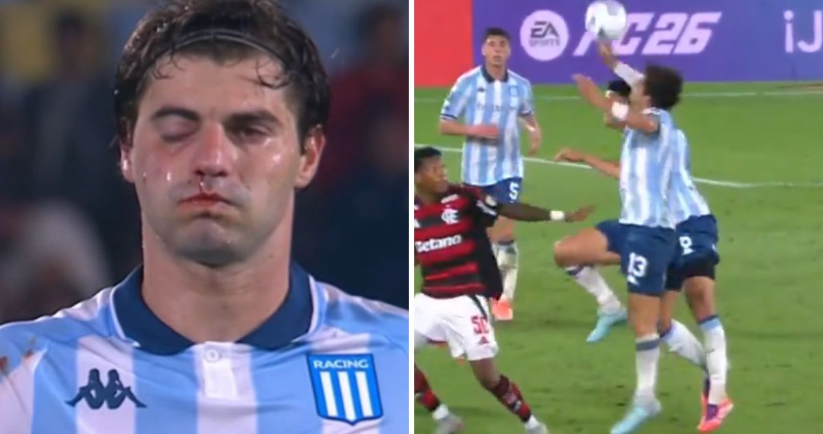 Capitán de Racing acabó con el rostro desfigurado tras codazo de compañero en Copa Libertadores.