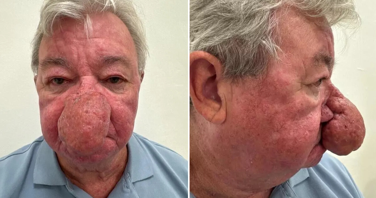 Caso de Gerard McAliece