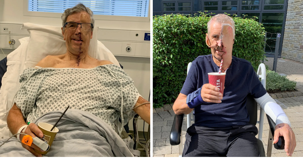 Hombre recibe "cara impresa en 3D"  