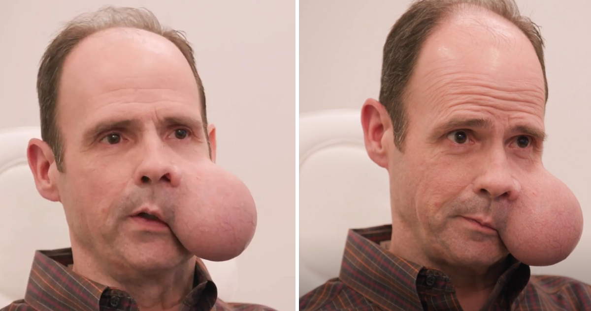 Caso de Ron en Estados Unidos