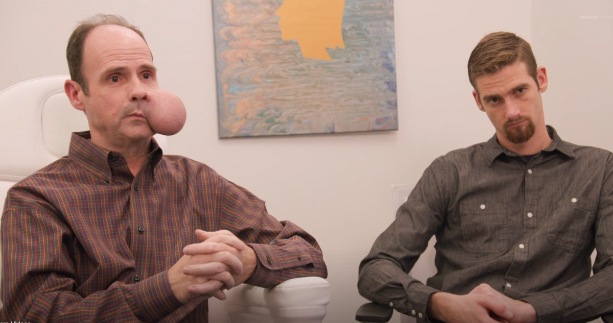 Hombre con tumor de 2 kilos en su cara