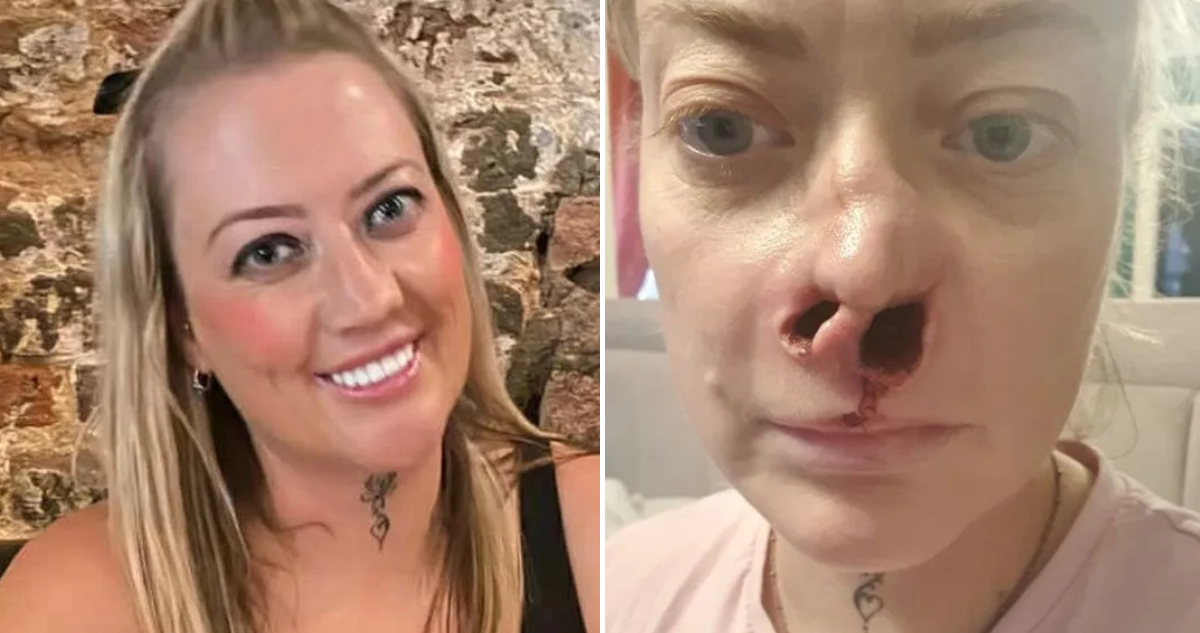 Caso de Leanne Abeyance