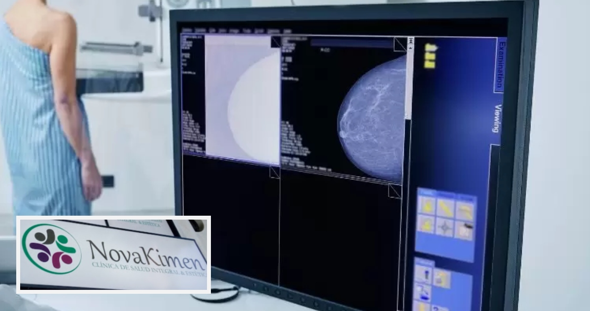 Mamografías falsas en la región del Bío Bío