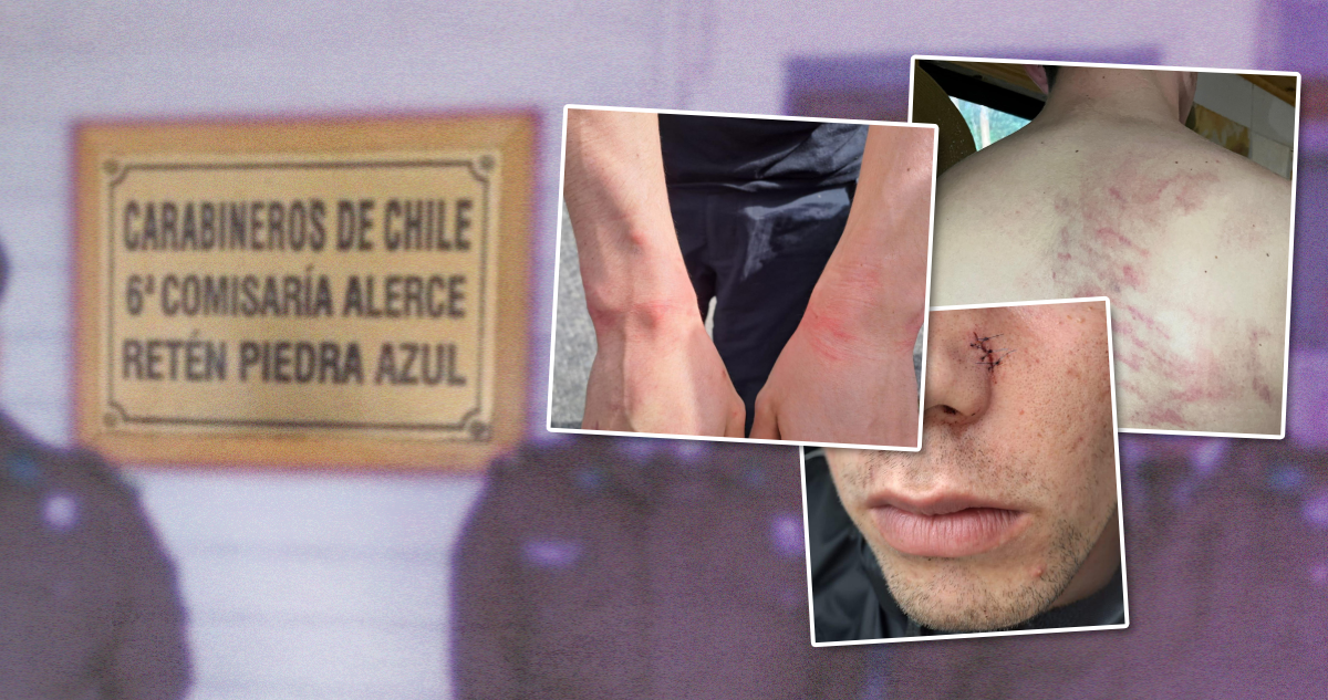 “Te vamos a violar”: cómo pelea acabó en denuncia de agresión a joven con TEA por parte de Carabineros