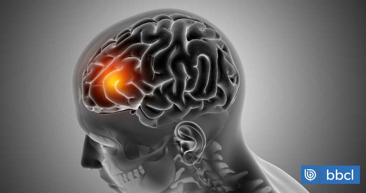 Cómo saber si una persona está teniendo un ACV: cada segundo es clave