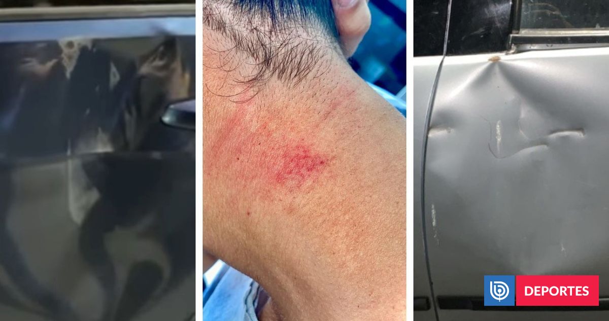 Escándalo en clásico Newell's-Rosario de futsal en Argentina: mordidas, autos rotos y denuncia