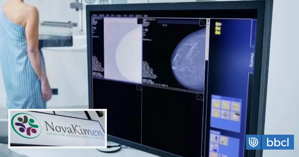 Más de 1.300 mujeres afectadas por mamografías falsas realizadas por centro médico en Bío Bío