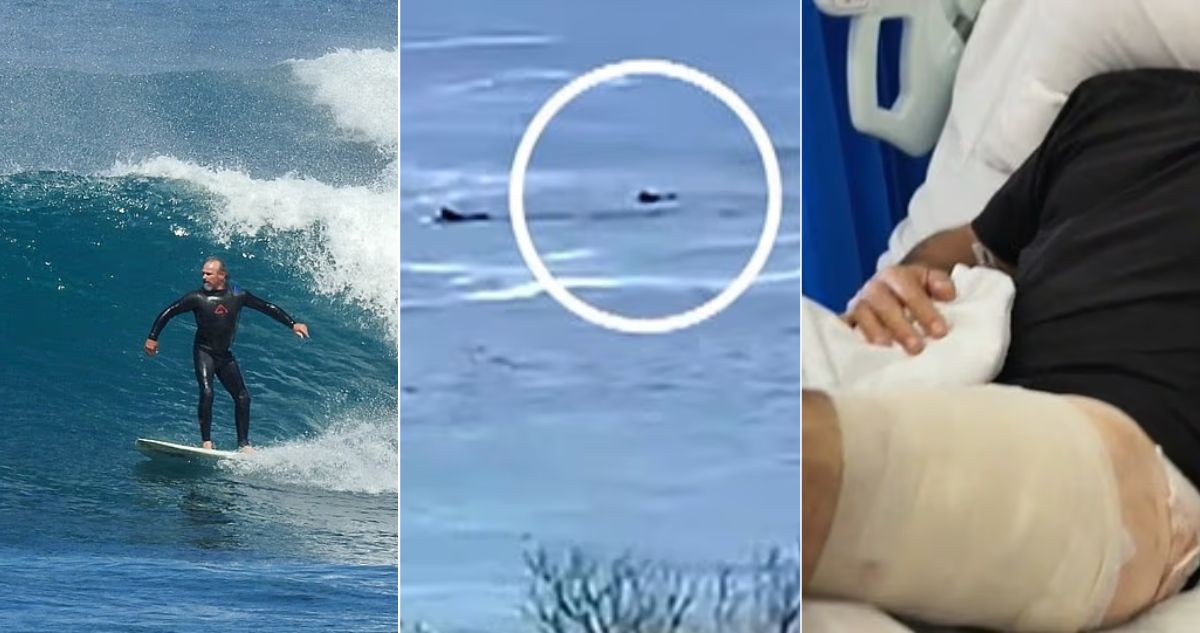 Sufrista se peleó con tiburón a los puños para seguir con vida