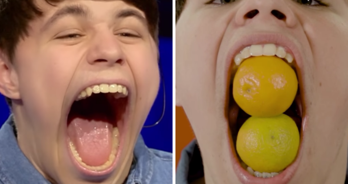 Joven obtuvo récord Guinness por “la mayor apertura de boca jamás registrada”: alcanzó 10 centímetros