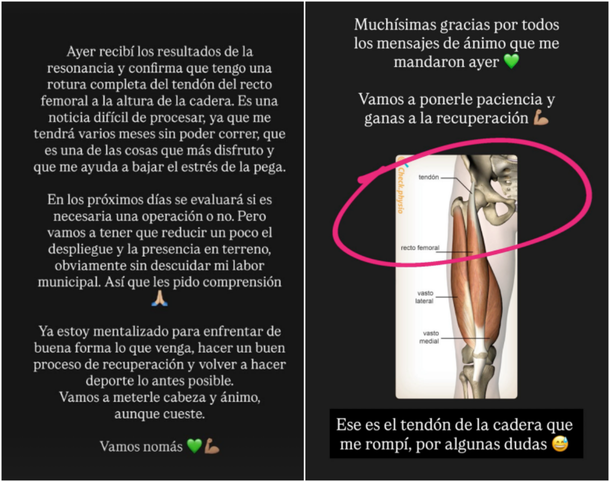 Alcalde Vodanovic actualiza estado de salud tras diagnóstico médico que limitará sus actividades