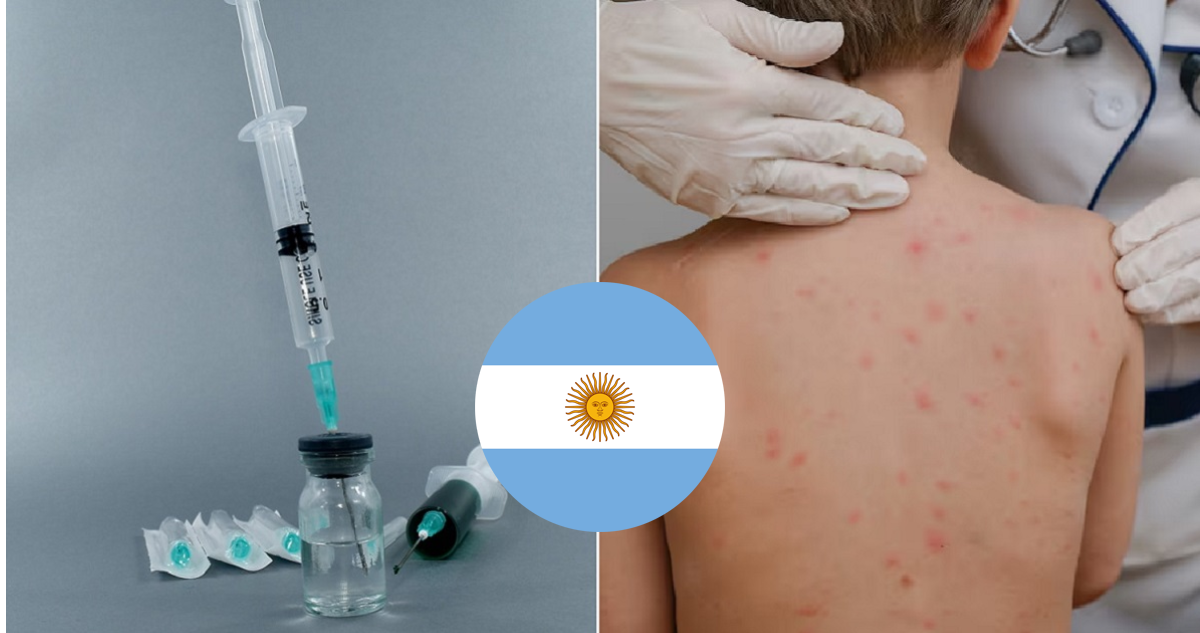 Imagen de referencia sobre la baja vacunación y casos de sarampión en Argentina.