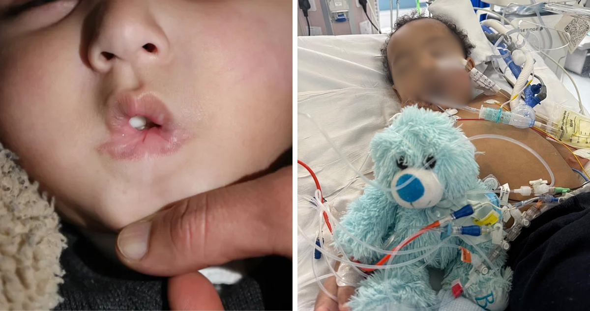 Bebé perdió la mitad de su lengua tras beber limpiador pensando que era leche en Inglaterra